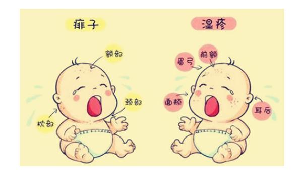 要怎么區(qū)分痱子和濕疹？夏季長痱子怎么應(yīng)對方法是？