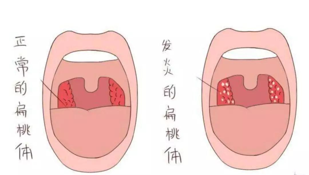 成都民生耳鼻喉醫(yī)院一大波優(yōu)惠活動來襲！耳鼻喉內(nèi)窺鏡檢查免費，預約從速！