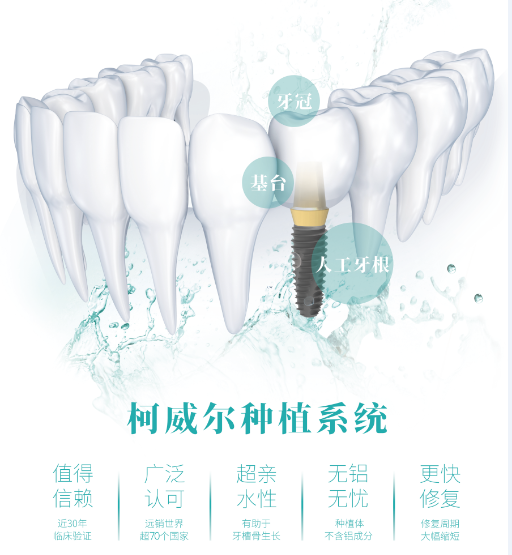 中家醫(yī)家庭醫(yī)生口腔：超親水柯威爾，治療周期短，最快6周種好牙