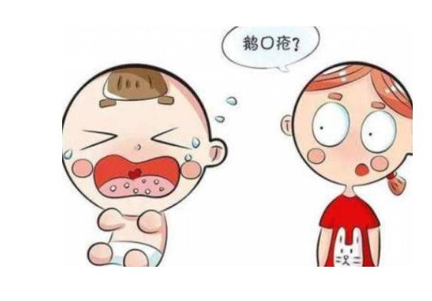 治療寶寶鵝口瘡有什么誤區(qū)？如何及時發(fā)現(xiàn)鵝口瘡？