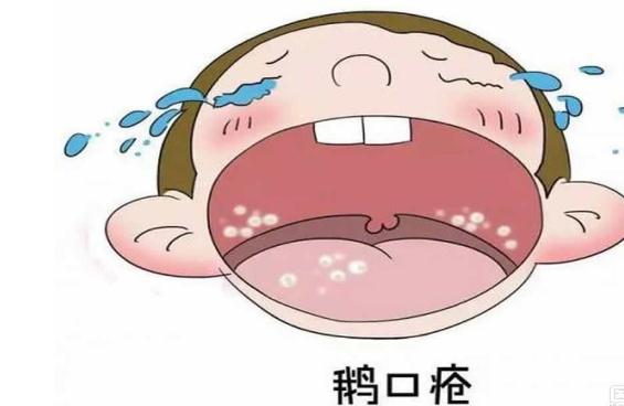 怎么預防寶寶鵝口瘡？鵝口瘡有哪些并發(fā)癥？