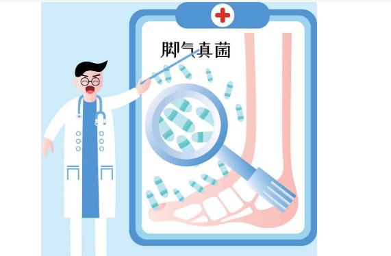怎么判斷自己得了腳氣？腳氣分有幾種類型？