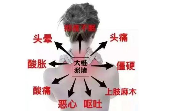頸椎病早期什么癥狀？頸椎病對(duì)身體都有什么害處？