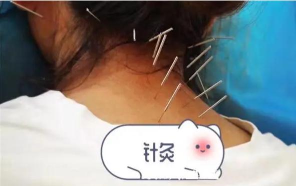 針灸對頸椎病有效果嗎？頸椎病是針灸好還是推拿好？