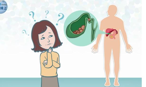膽結(jié)石和膽囊炎有什么區(qū)別？患膽囊炎不能吃什么？