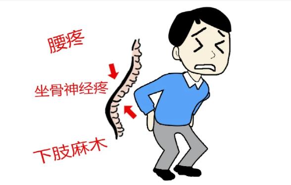 腰間盤(pán)突出早期什么癥狀？腰間盤(pán)突出哪些危害？