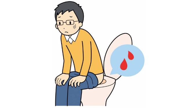 痔瘡犯了便血時(shí)該怎么辦？痔瘡吃什么藥好得快？