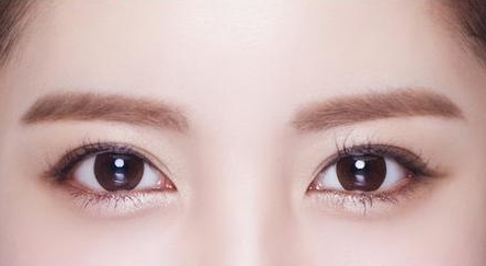 王海木課堂：全切雙眼皮后，出現(xiàn)這些癥狀不要慌