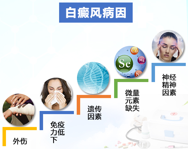 【誘因不明，治療不靈】白癜風的病因要如何檢查出來?這4個步驟不能少！