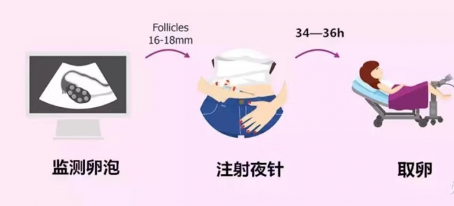 取卵前必看！原來夜針決定著卵子生死和試管成??！