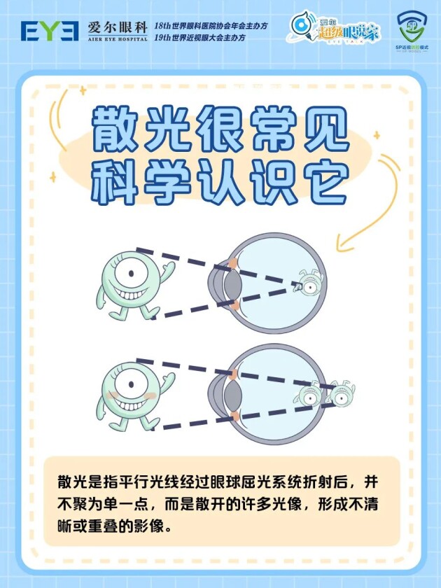 【合肥愛爾眼科】孩子散光多少度，需要配眼鏡？