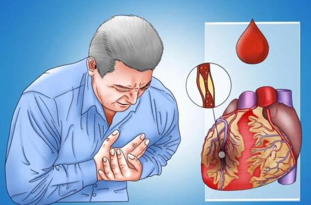 冠心病能吃羊肉嗎？冠心病能吃雞蛋嗎？