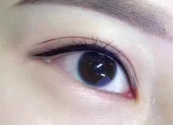 美瞳線暈色怎么辦 美瞳線后期暈色怎么回事