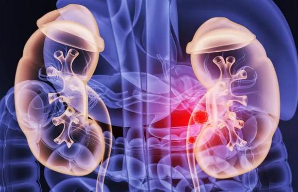 平時我們怎么保護(hù)腎臟嗎？慢性腎臟病成因兒童與成人不同？