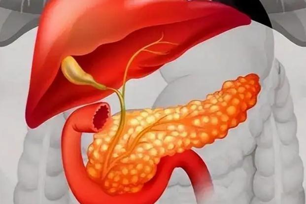 為何多數(shù)人在確診胰腺癌時(shí)都為晚期 ？遠(yuǎn)離胰腺癌，重在預(yù)防？