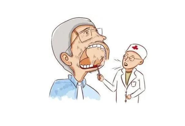 口腔癌是什么引起的？口腔癌的早期癥狀？