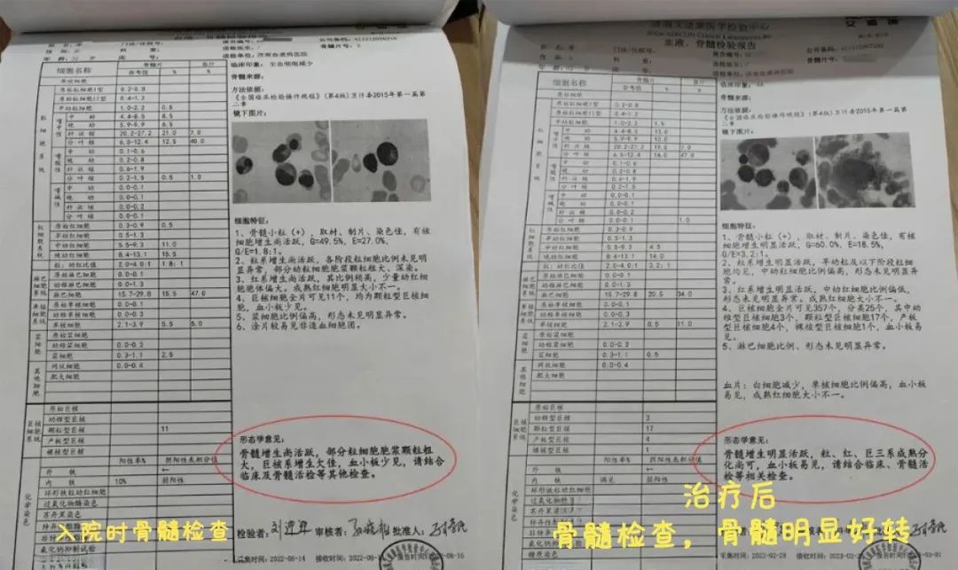 濟(jì)南血液病醫(yī)院：多地治療未查明，我院明確全血減少治療后血象恢復(fù)