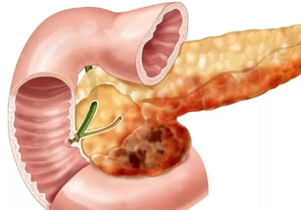 胰腺炎為什么不能喝水？狗狗胰腺炎能治好嗎？