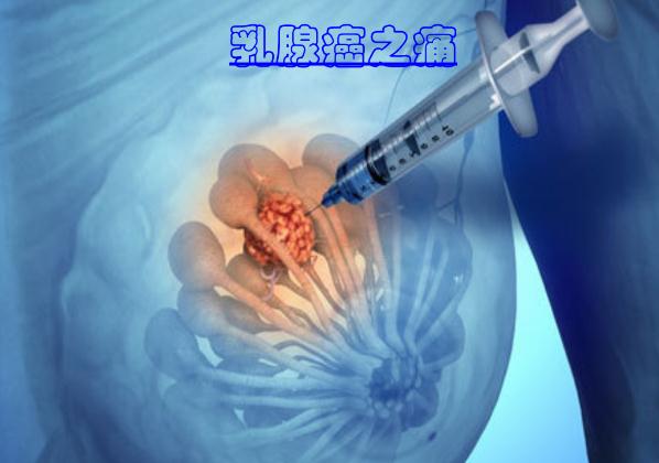 這些食物可以預防乳腺癌 ？乳腺癌手術后多久化療？