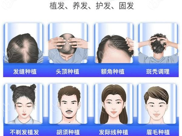 植發(fā)后會掉發(fā)嗎 植發(fā)手術前注意什么