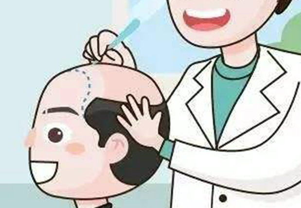 額頭高可以植發(fā)嗎 發(fā)際線(xiàn)高可以植發(fā)嗎