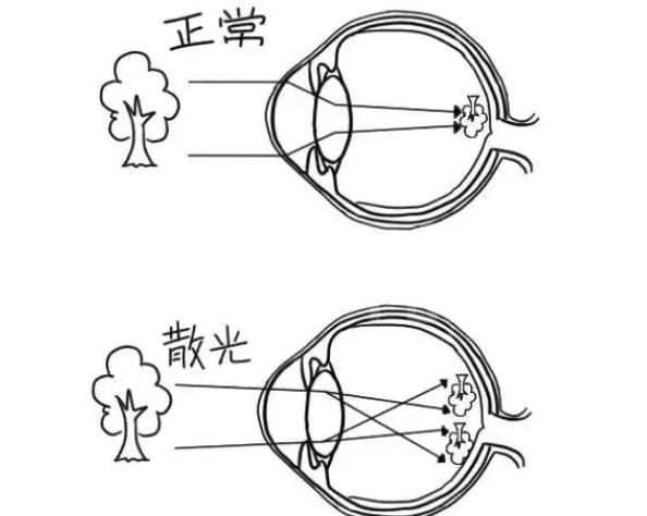 散光眼鏡要一直戴著嗎 散光200度需要配眼鏡嗎