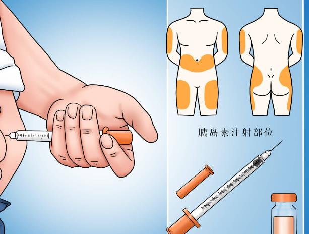 不吃甜食會(huì)得糖尿病嗎 不吃甜食會(huì)改善胰島素抵抗嗎