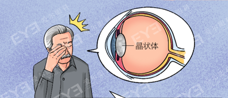合肥愛爾眼科科普：做白內(nèi)障手術(shù)，一定要開刀嗎？