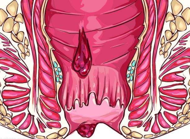 馬應(yīng)龍痔瘡膏去黑眼圈嗎 馬應(yīng)龍痔瘡膏價格多少