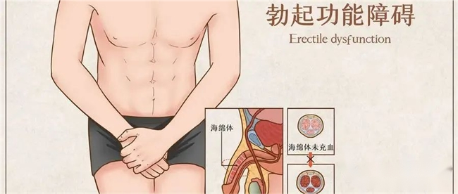 了解西地那非功效與作用，做真男人，挺你的實力本色