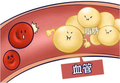 健康小知識|膽固醇的正常值范圍是多少？“超標”怎么辦？