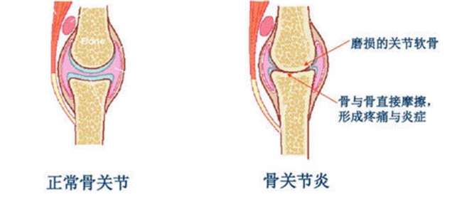 優(yōu)得寧和西樂葆的區(qū)別揭秘：看著相似，實則大有不同
